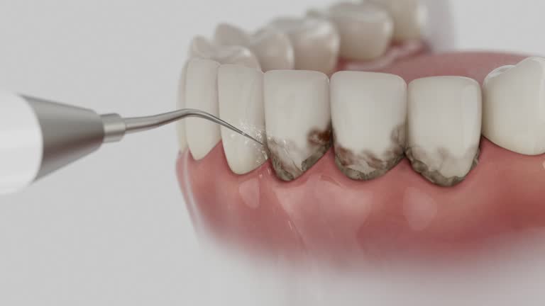 Reliable Dental Implants contractor in Belmont, MS by Smile Center Dentistry